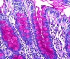 Pathology, Stains & Dyes